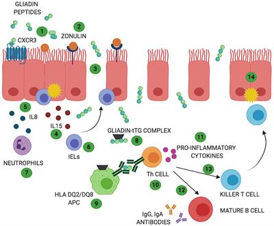 Celiac Disease and Non-celiac Wheat Sensitivity: State of Art of Non-dietary Therapies